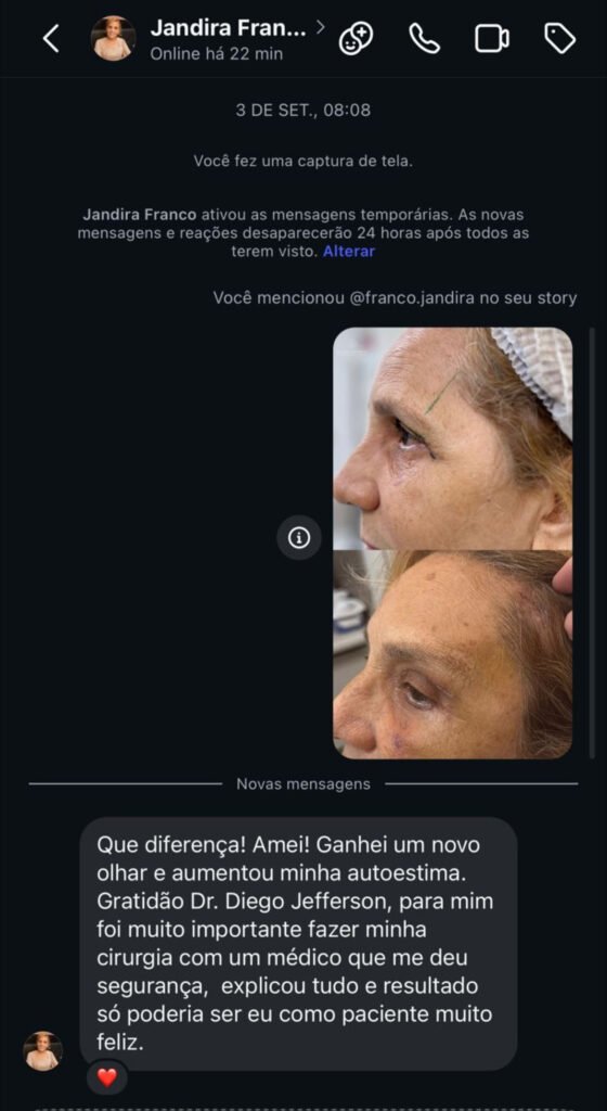 avaliação para rinoplastia em Teresina
